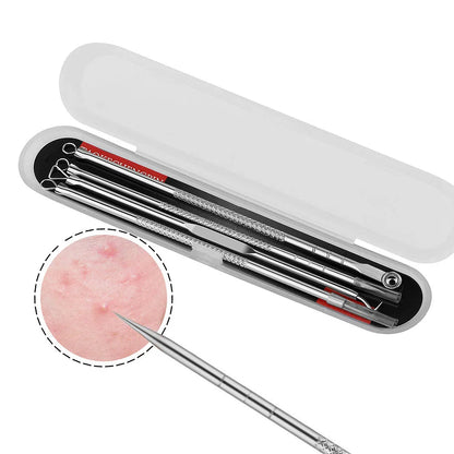 Acne Blackhead Removal Set